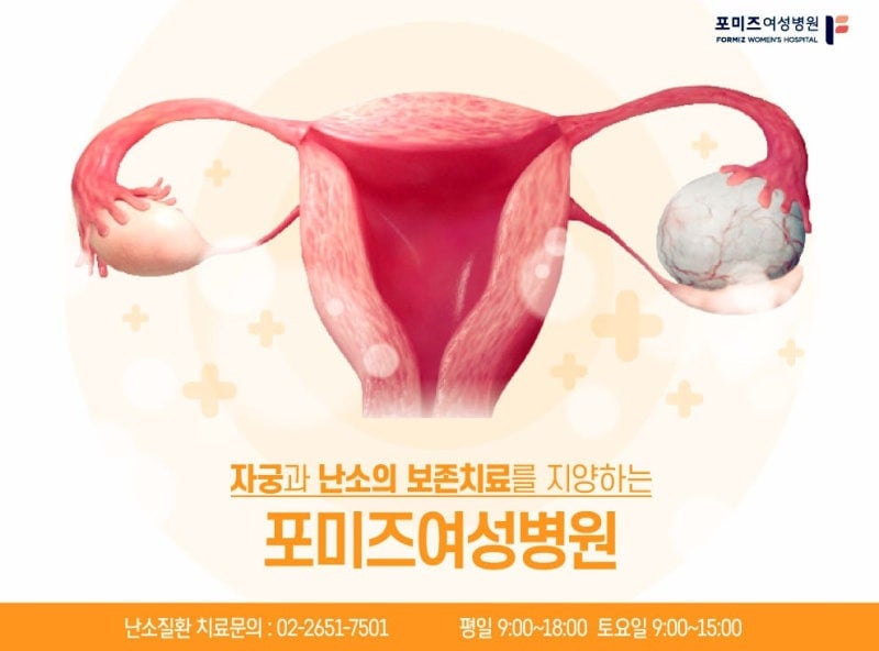 나 아니야..?싶은 난소낭종 증상 | 인스티즈