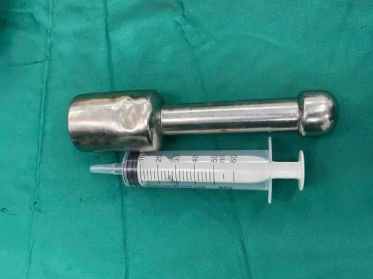 18cm 절구공이 항문에 박혀 입원한 베트남 15세 소년 | 인스티즈