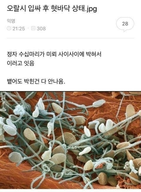 ㅇㄹ...하지마소서... ㅠ(비위상함주의) | 인스티즈