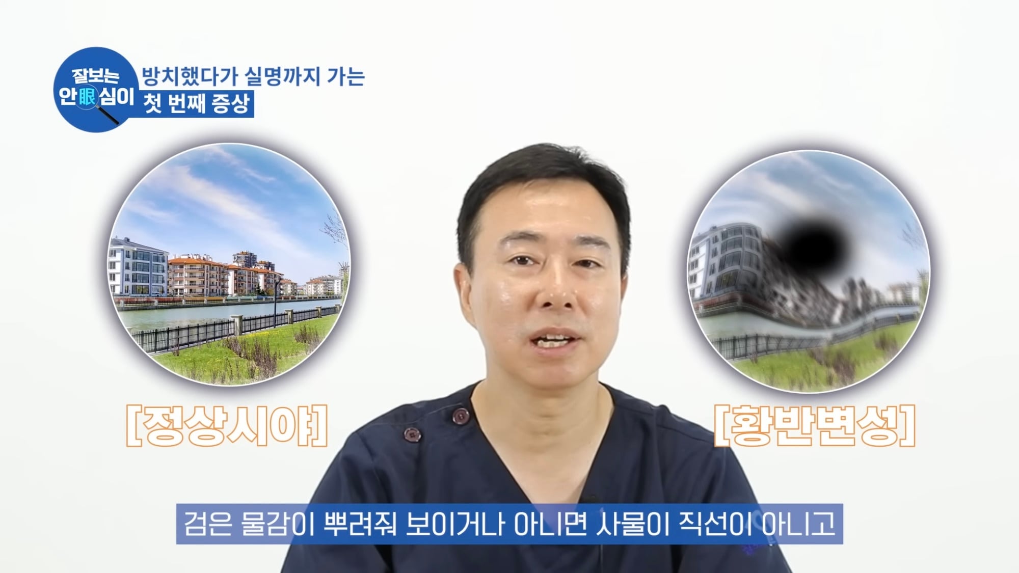 눈이 실명 전 잠깐 보내는 마지막 신호. 이 증상이 보인다면 당장 병원 뛰쳐가세요.jpg | 인스티즈