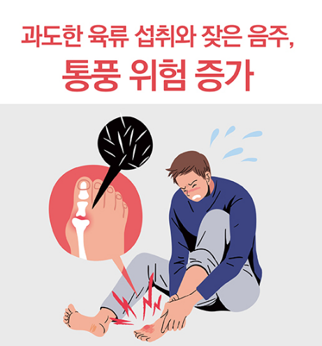 '1일1닭' ' 단백질 열풍' 폭탄 터지나 - 통풍 환자 2배로 증가 , 대안은? | 인스티즈