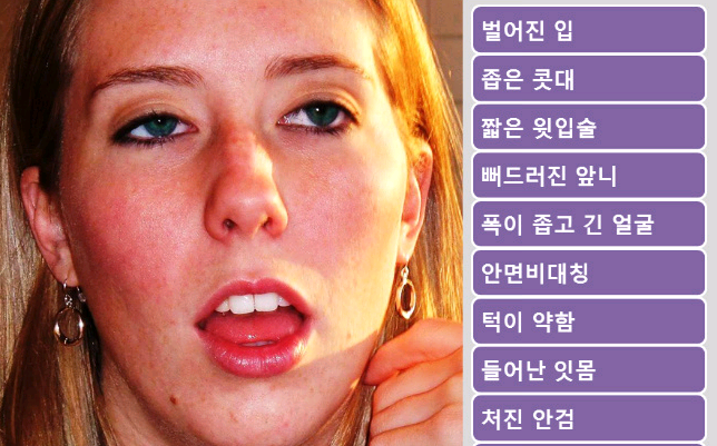 어릴 때 입으로 호흡한 결과.... | 인스티즈