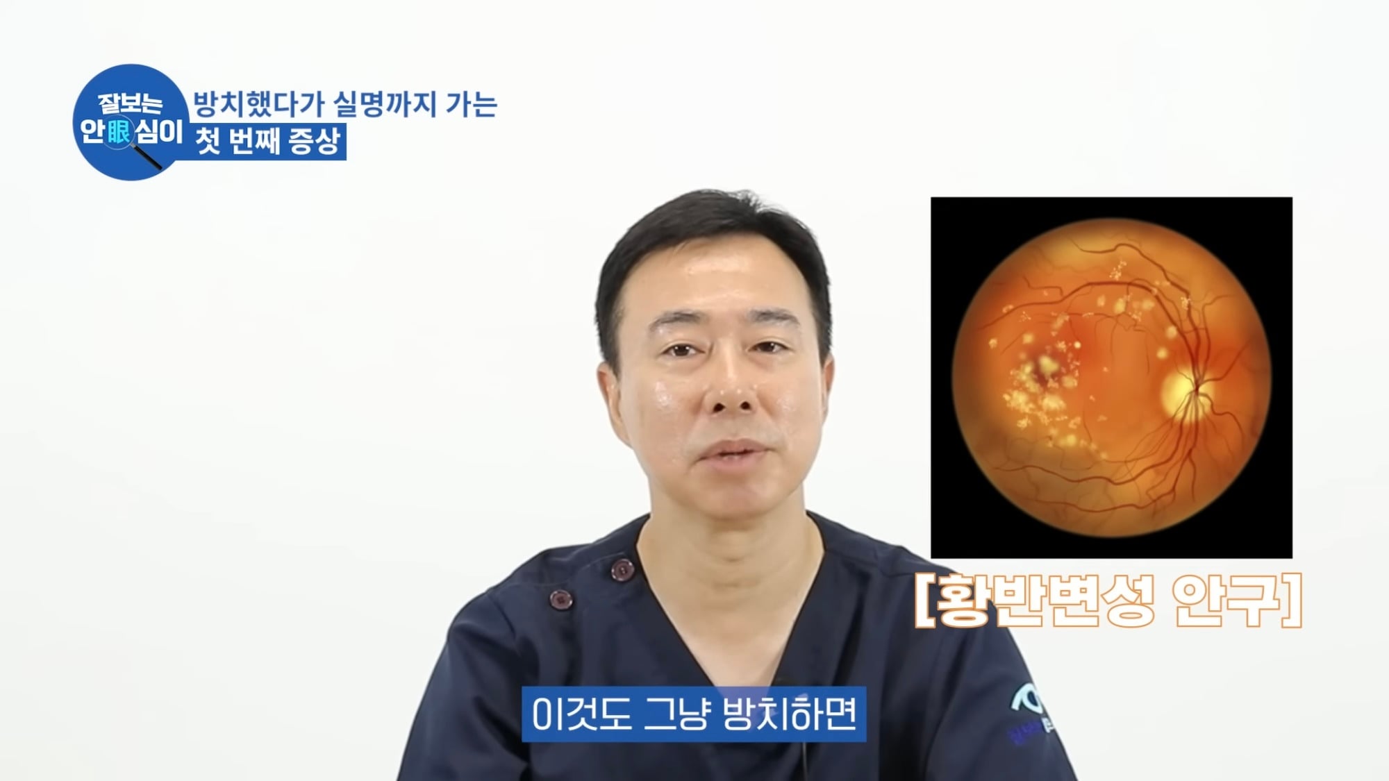 눈이 실명 전 잠깐 보내는 마지막 신호. 이 증상이 보인다면 당장 병원 뛰쳐가세요.jpg | 인스티즈