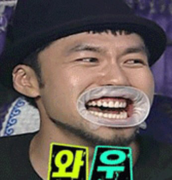 개구기 장착한 연예인들 | 인스티즈