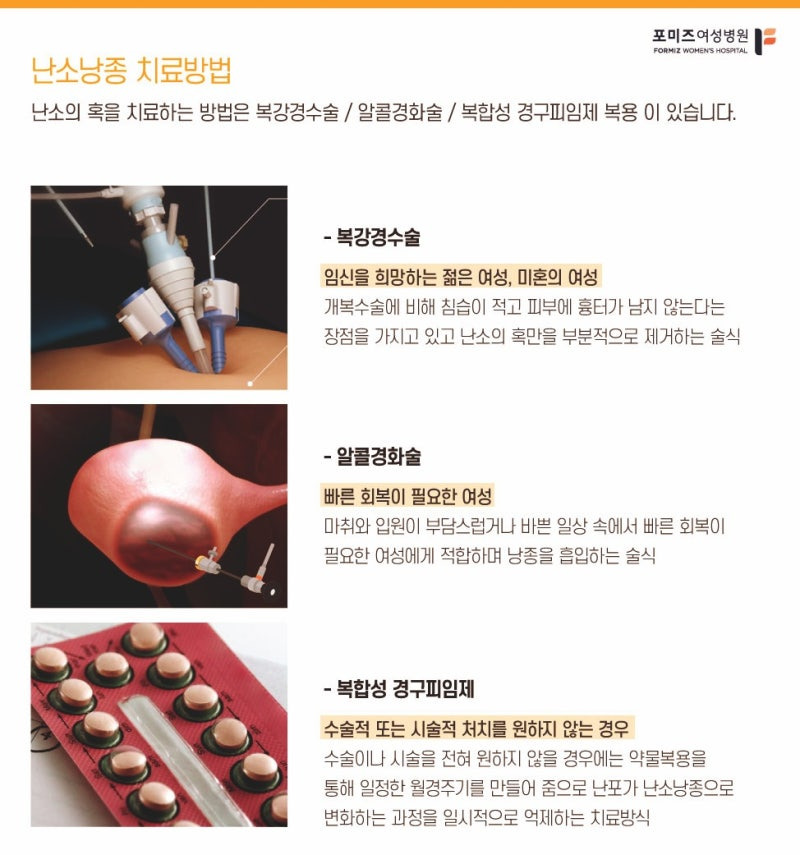 나 아니야..?싶은 난소낭종 증상 | 인스티즈