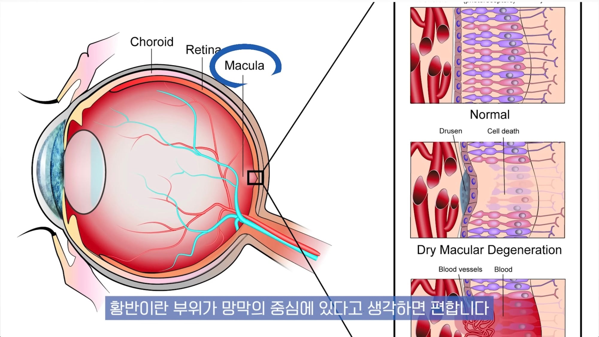 눈이 실명 전 잠깐 보내는 마지막 신호. 이 증상이 보인다면 당장 병원 뛰쳐가세요.jpg | 인스티즈