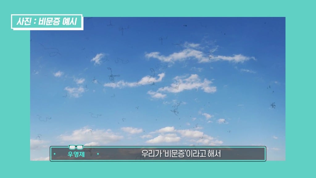 라식, 라섹할 때 눈 움직이면 어케 될까? | 인스티즈
