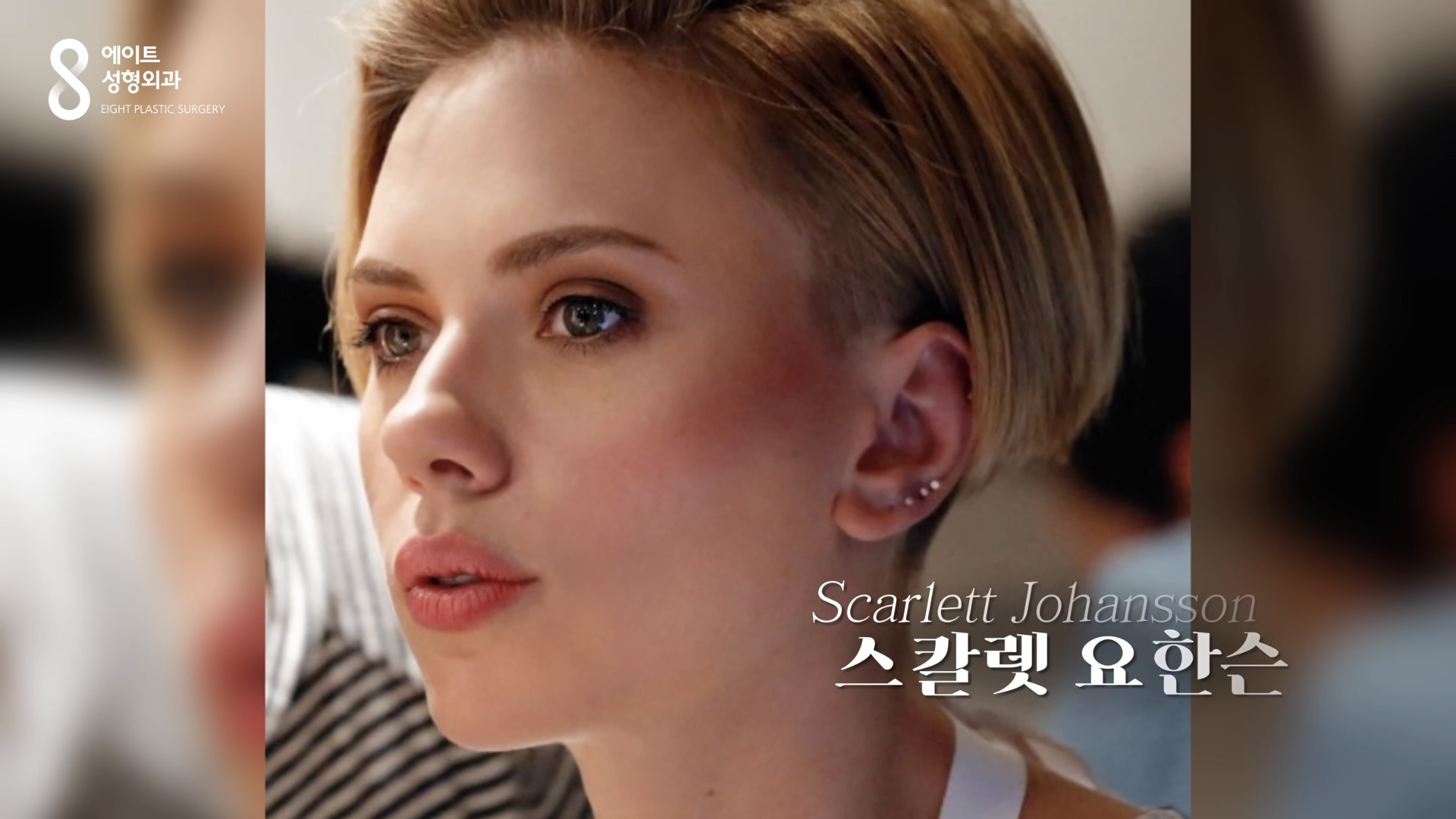 요즘 중국에서 유행이라는 코수술 모양.jpg | 인스티즈