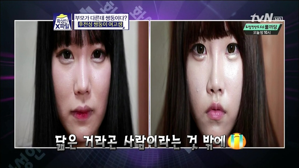 [화성인X파일] 후천성 쌍둥이 여고생 | 인스티즈