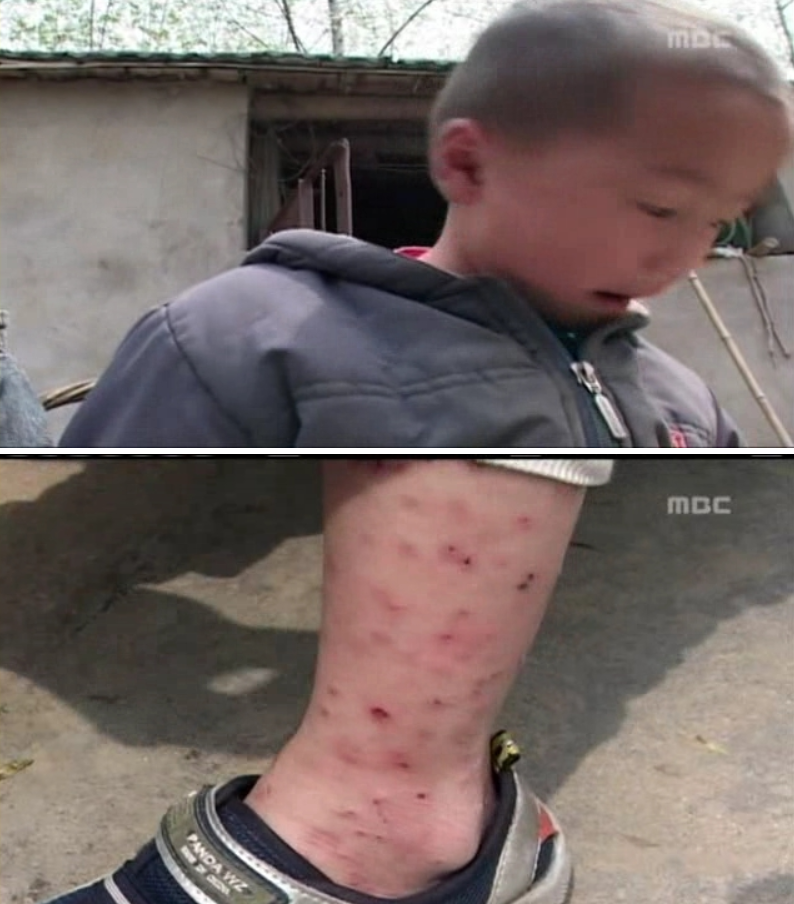 중국의 피 팔아서 에이즈 천국된 농촌마을 ㄷㄷㄷ | 인스티즈