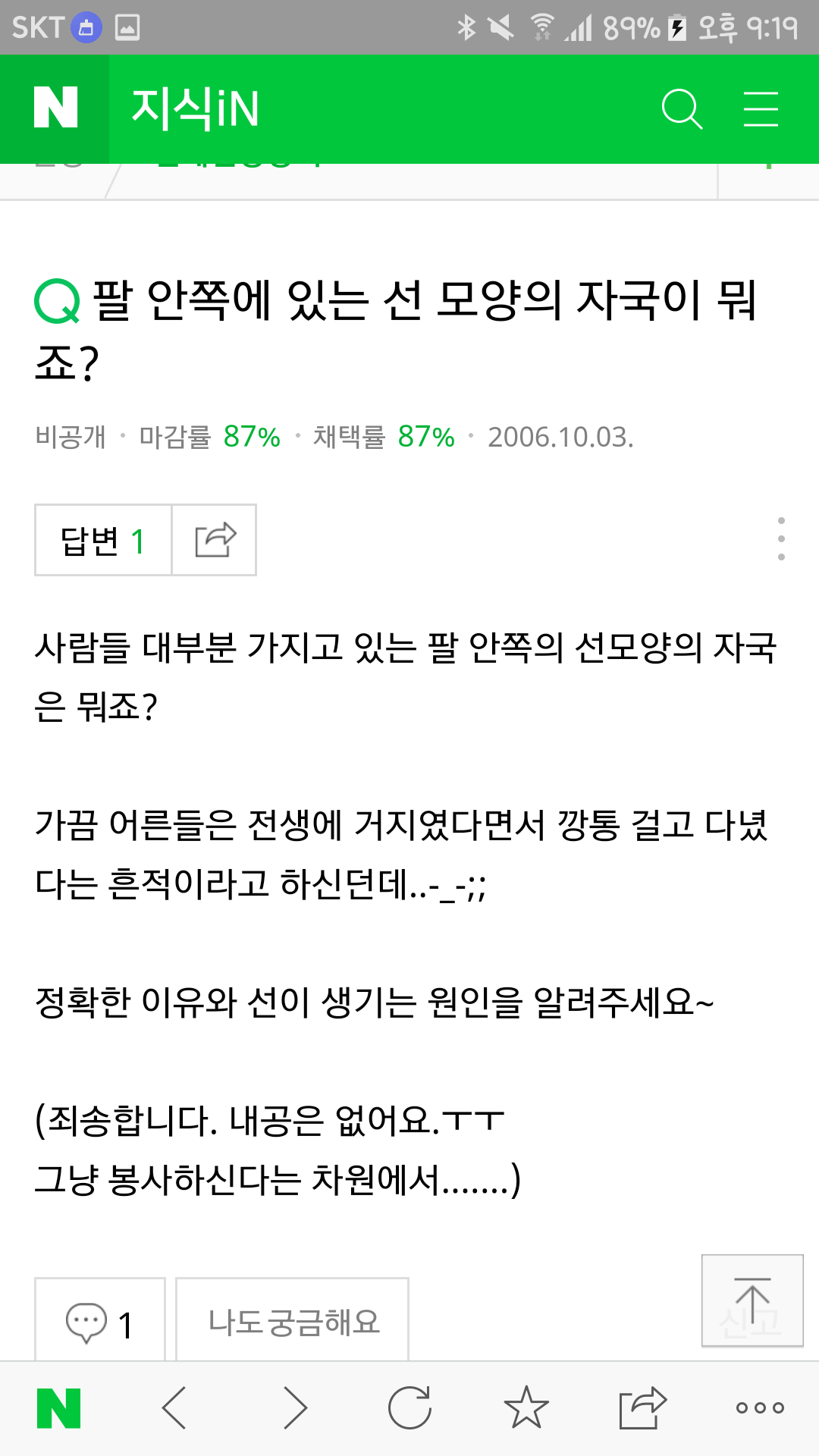 팔 안 쪽에 있는 주름 : 거지선 | 인스티즈