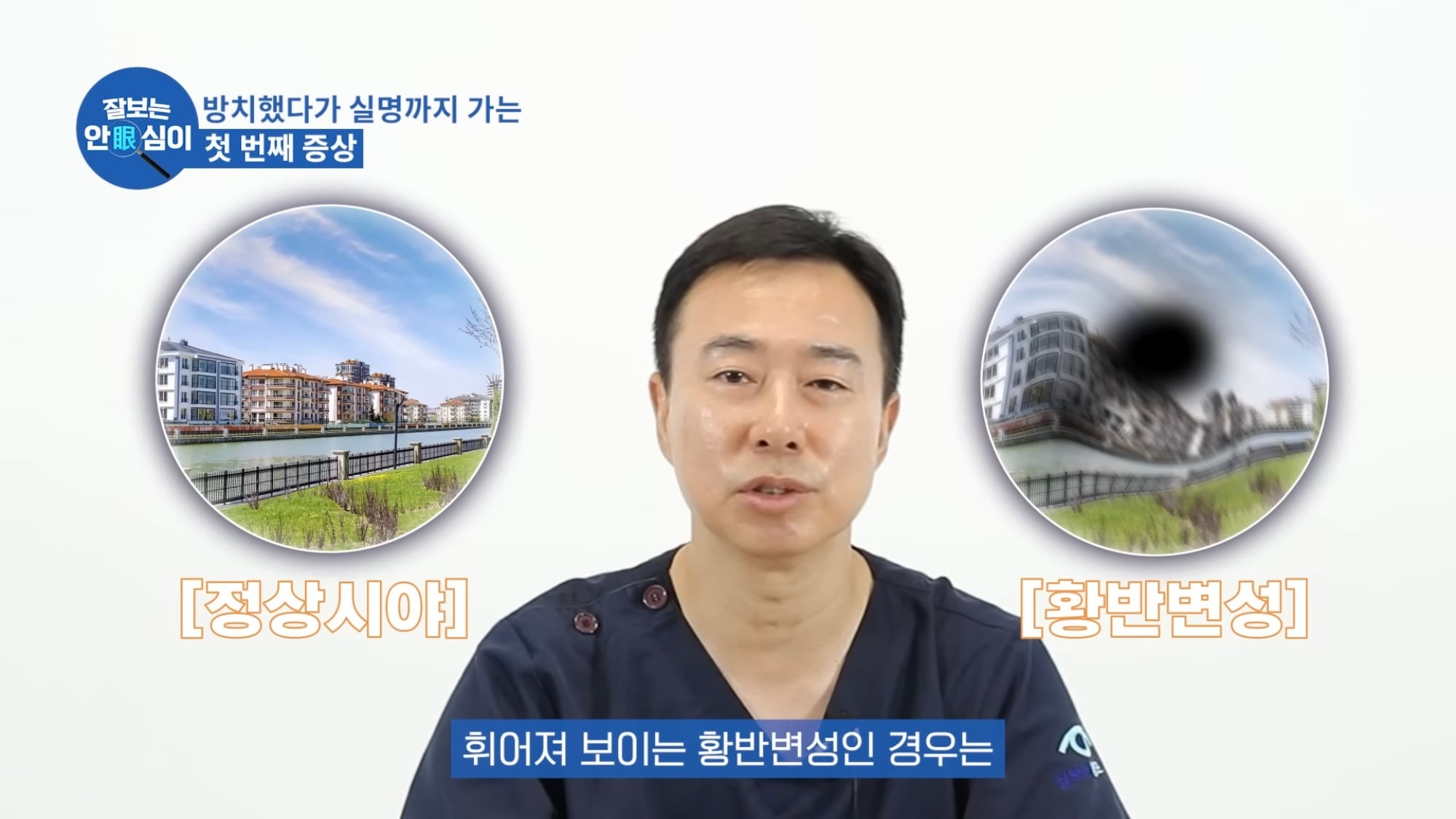 눈이 실명 전 잠깐 보내는 마지막 신호. 이 증상이 보인다면 당장 병원 뛰쳐가세요.jpg | 인스티즈