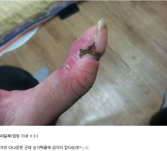 뱀에 물리면 빨리 병원 가야하는 이유 | 인스티즈