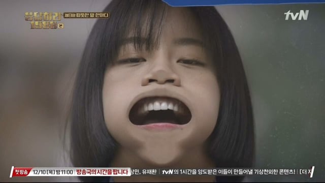 개구기 장착한 연예인들 | 인스티즈