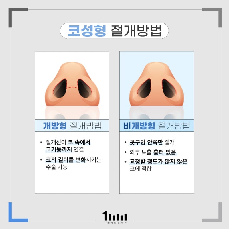 코 절개선 자국 블러처리하는 남돌 | 인스티즈