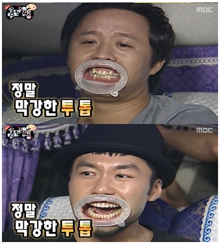 개구기 장착한 연예인들 | 인스티즈