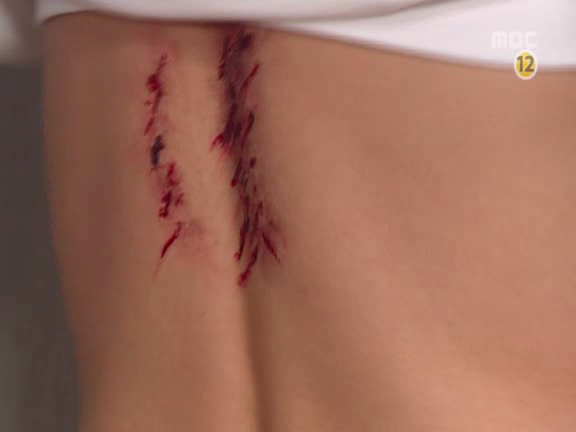 [거침없이하이킥] 민호보다 더 크게 다쳤는데 사람들이 몰라줘서 억울한 윤호.jpg | 인스티즈