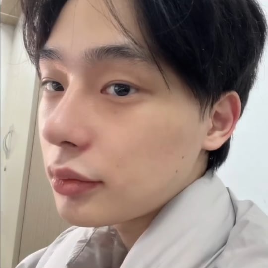 남자 성형 전후 눈+코+윤곽 | 인스티즈