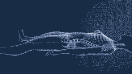 트랜스젠더 수술하는과정(남자-＞여자).gif | 인스티즈