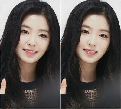 컴플렉스라는 아이린 팔자주름 제거해봄 | 인스티즈