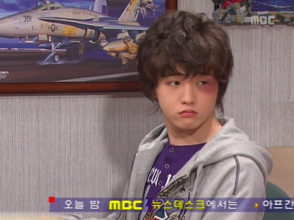 [거침없이하이킥] 민호보다 더 크게 다쳤는데 사람들이 몰라줘서 억울한 윤호.jpg | 인스티즈