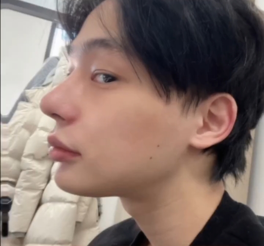 남자 성형 전후 눈+코+윤곽 | 인스티즈