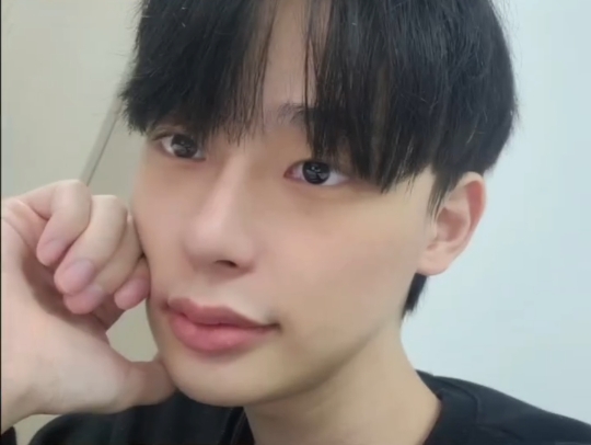 남자 성형 전후 눈+코+윤곽 | 인스티즈