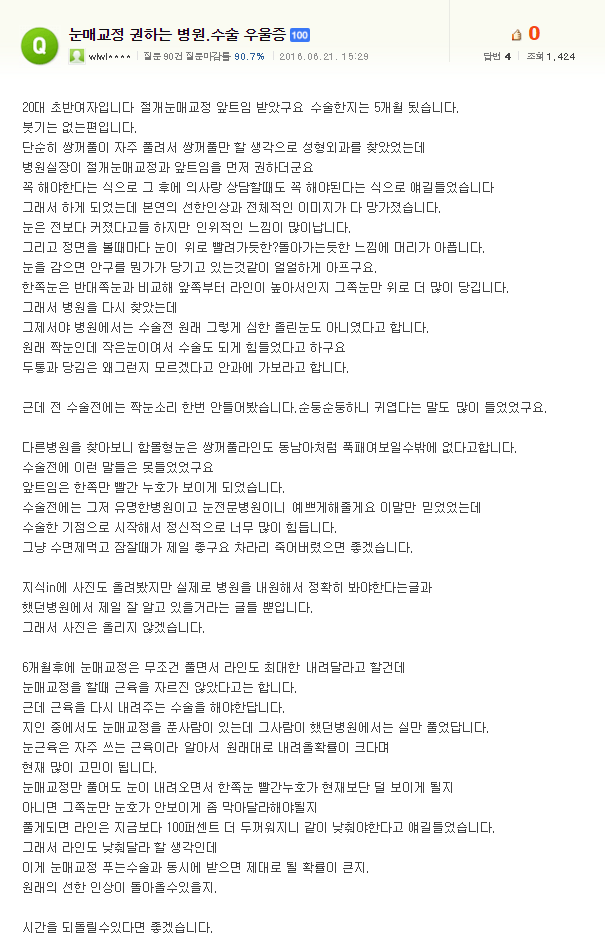 눈매교정의 진실 | 인스티즈