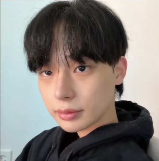 남자 성형 전후 눈+코+윤곽 | 인스티즈