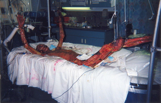 방사능의 무서움2 (시룸오사진 주의) | 인스티즈