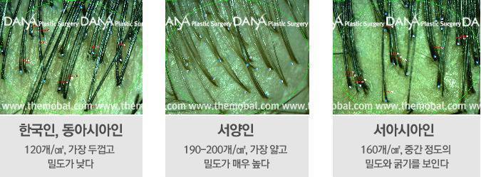 동양인이 수염이 안어울리는 이유.jpg | 인스티즈