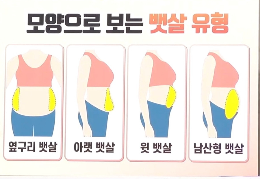 뱃살 유형 | 인스티즈