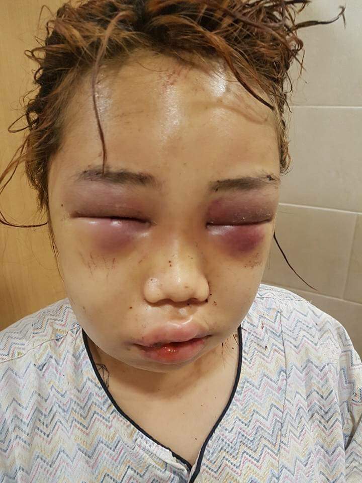 부산여중생폭행사건 피해자 사진 추가로 나온것.. | 인스티즈