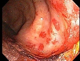 방사능의 무서움2 (시룸오사진 주의) | 인스티즈