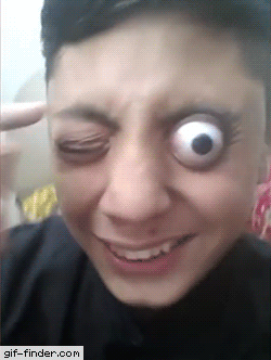 혐주의) 안구 돌출 | 인스티즈