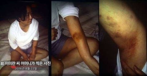 아빠가 자식시켜서 엄마 가두고 몇달동안 고문하다가 발가벗기고 피멍투성이인채로 묶고 버려서 엄마 자살함 | 인스티즈