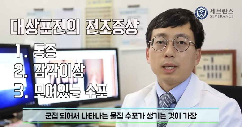 대상포진 전조 증상..... | 인스티즈