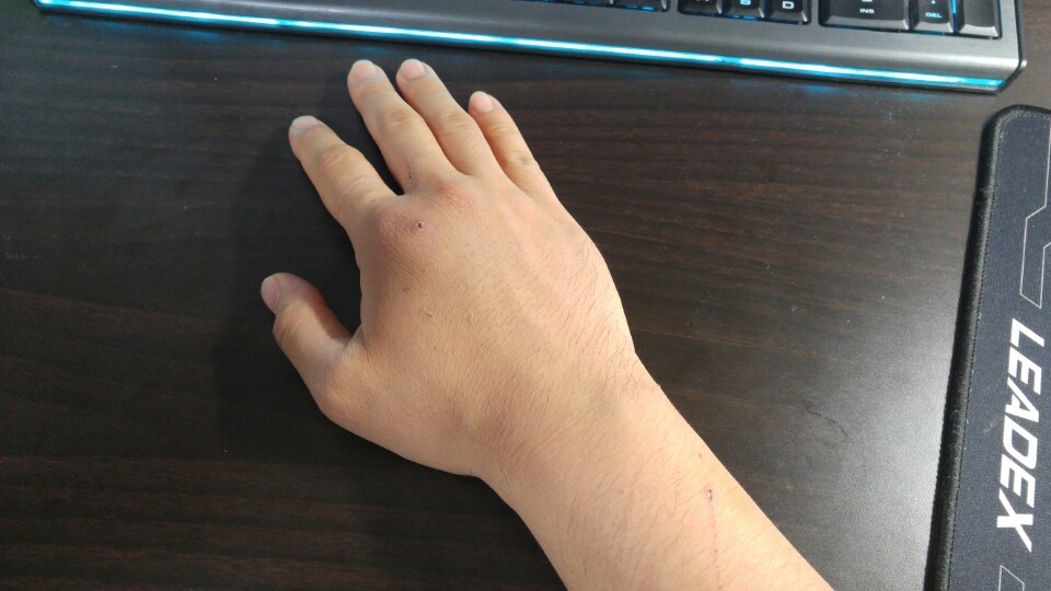 고양이한테 물리면 바로 병원가야하는 이유 | 인스티즈