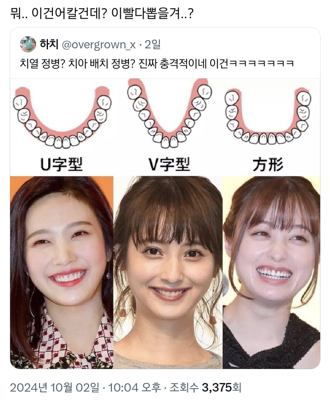 중안부 외모 집착을 능가하는 일녀들의 치아 배열 정병.twt | 인스티즈