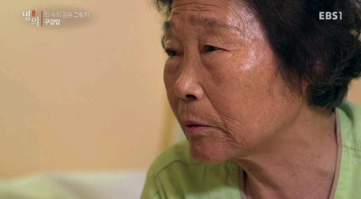 구강암 환자들은 혀를 잘라야한다는 사실에 큰 심리적 충격을 받는다.jpg | 인스티즈