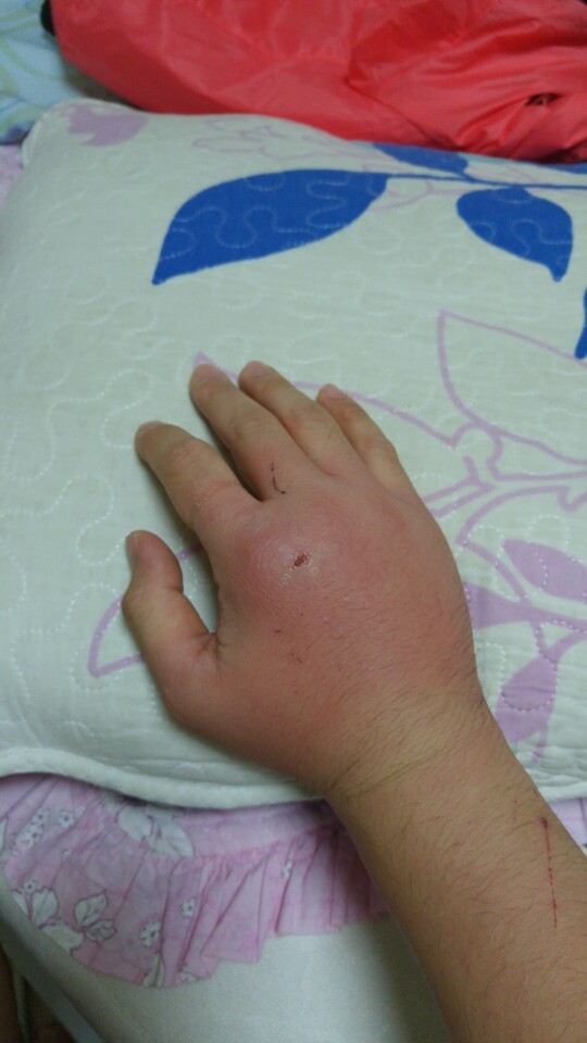 고양이한테 물리면 바로 병원가야하는 이유 | 인스티즈