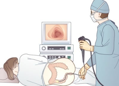 BL물 좀 좋아해봤다는 여자가 항문 내시경후 느끼는 점...jpg | 인스티즈