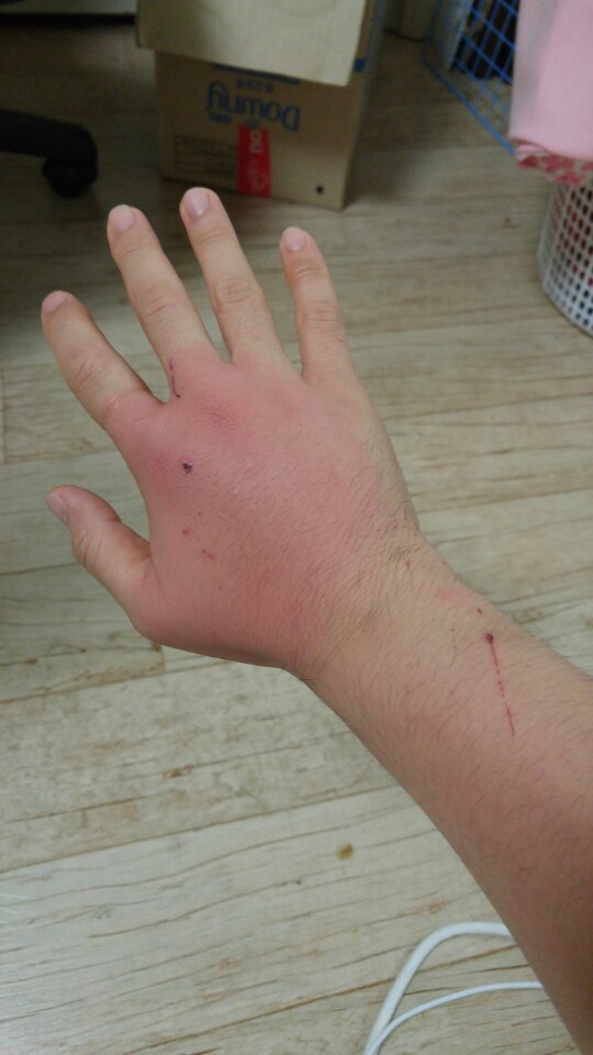 고양이한테 물리면 바로 병원가야하는 이유 | 인스티즈