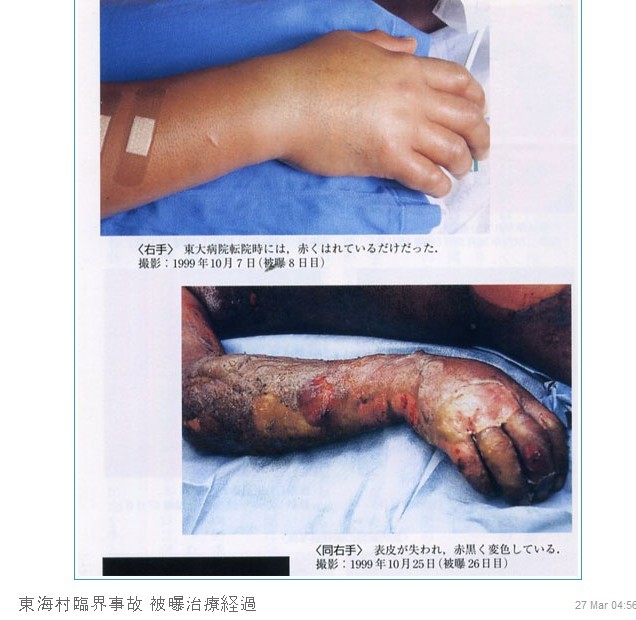 방사능의 무서움2 (시룸오사진 주의) | 인스티즈