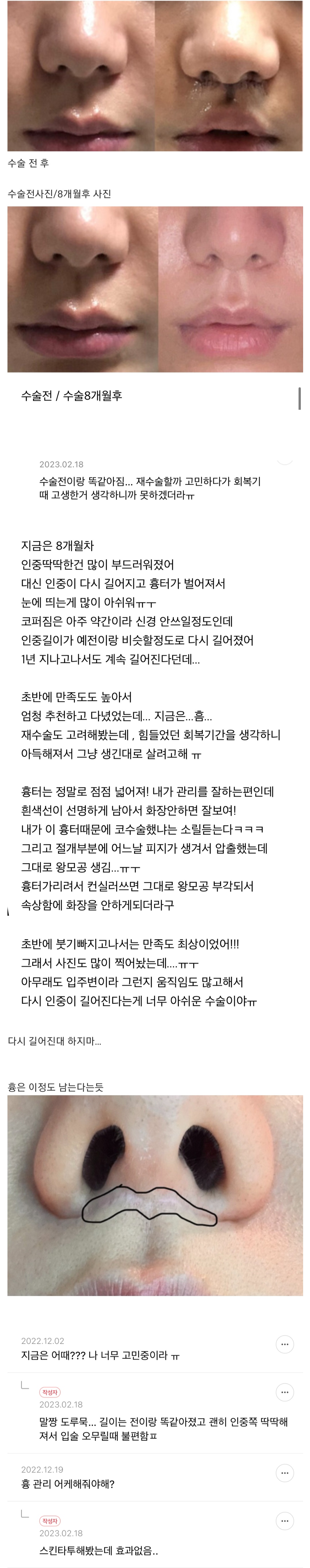 요즘 핫하다는 성형수술. jpg | 인스티즈