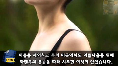 목 길이를 늘리기 위해 5년간 원주민들의 고리를 착용하고 다닌 미국인 | 인스티즈