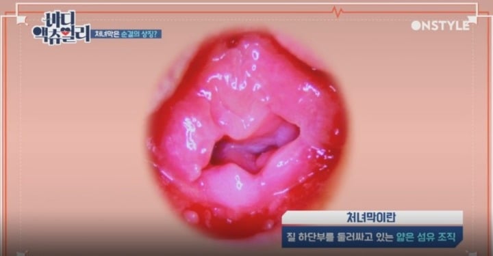 실제 처녀막 사진.jpg | 인스티즈
