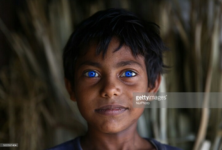 사람들이 하는 오해: 아시아 사람들은 다 눈동자가 짙은갈색? | 인스티즈