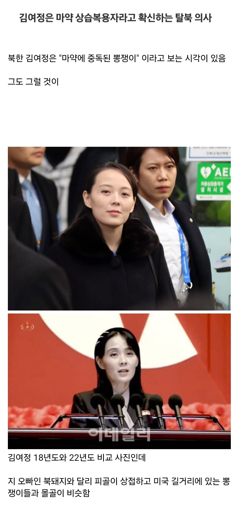 북한 김여정 심각하게 마른 이유 생각해보는 글 | 인스티즈