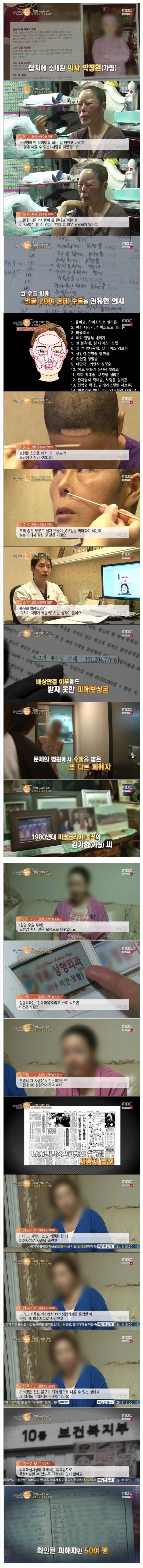 확인된 피해자만 50명 싸이코 성형외과 의사 | 인스티즈